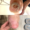 antes-y-despues-ulcera-