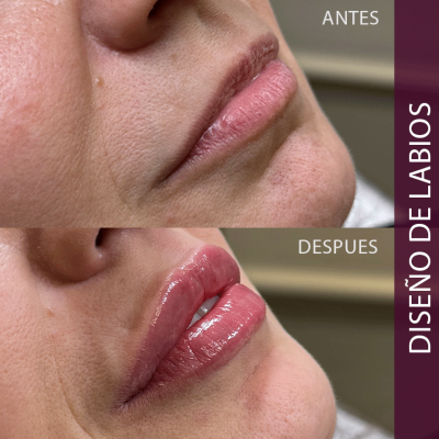 LABIOS 01